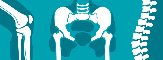 Graphic of bones in the knee, hip, and spine